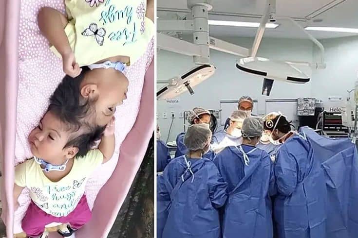 Mucize ameliyat trajediyle bitti: Minik kalpleri ayrılığa dayanamadı Mucize ameliyat trajediyle bitti: Minik kalpleri ayrılığa dayanamadı